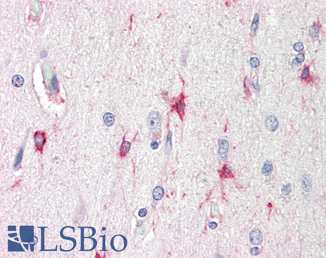 IHC-plus™ Polyclonal Goat anti-Human BAG3 / BAG-3 Antibody (aa537-548, IHC, WB)