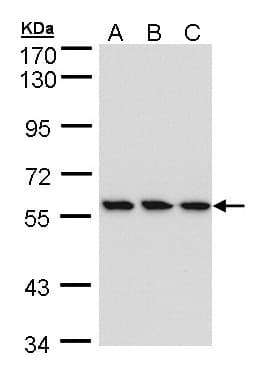IHC-plus™ Polyclonal Rabbit anti-Human RNGTT / HCAP Antibody (IHC, WB)