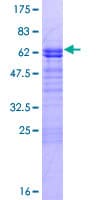 Human LMOD3 Protein (Recombinant GST)