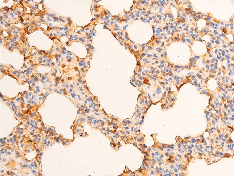 Polyclonal Rabbit anti-Human JUN / c-Jun Antibody (phospho-Tyr170, IHC, WB)