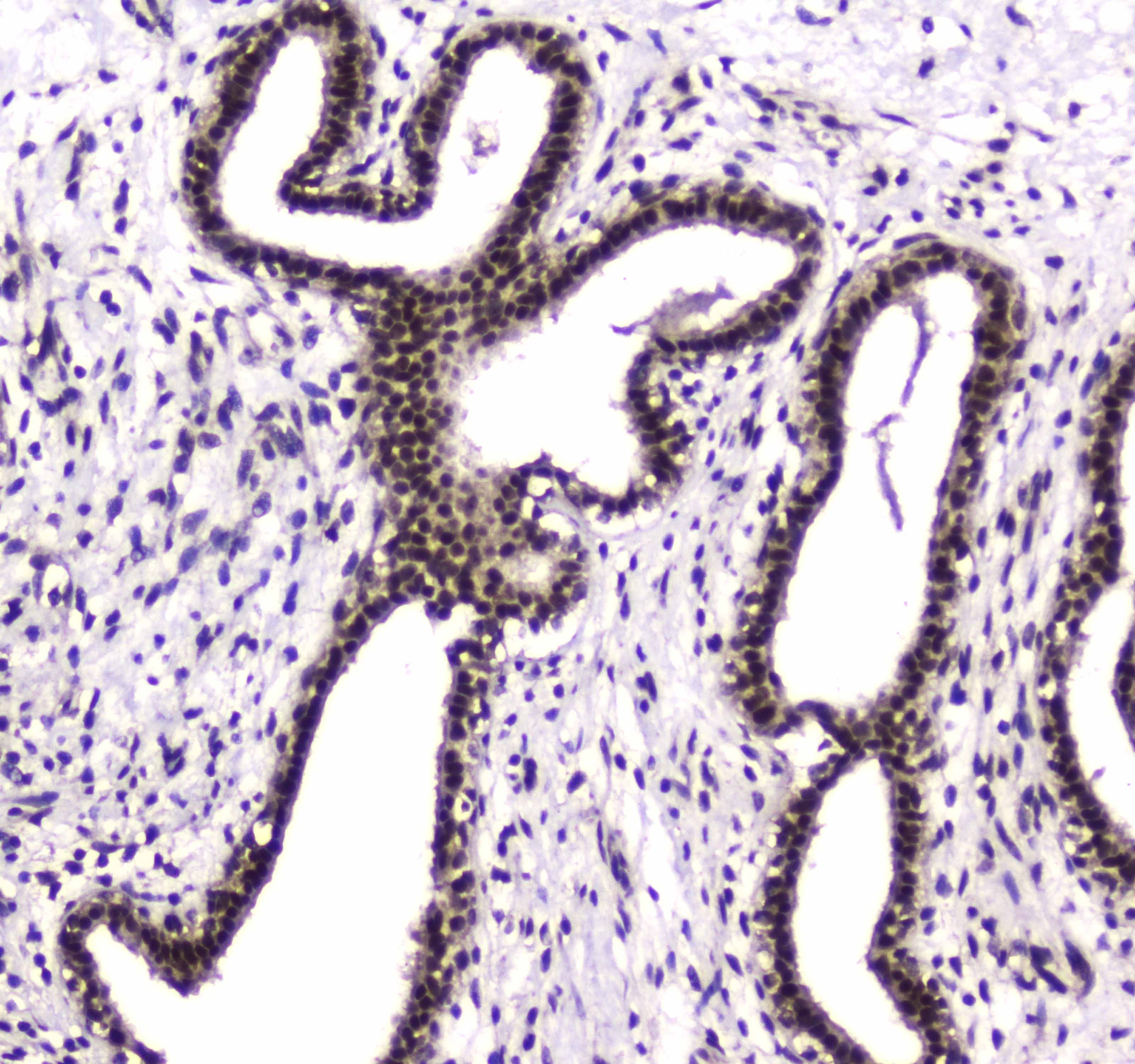 PARN Antibody