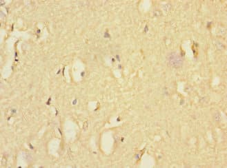 EAF2 / U19 Antibody