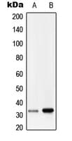 RRAD Antibody (Internal)