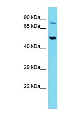 Polyclonal Rabbit anti-Human SLC44A2 / CTL2 Antibody (aa259-308, IHC, WB)
