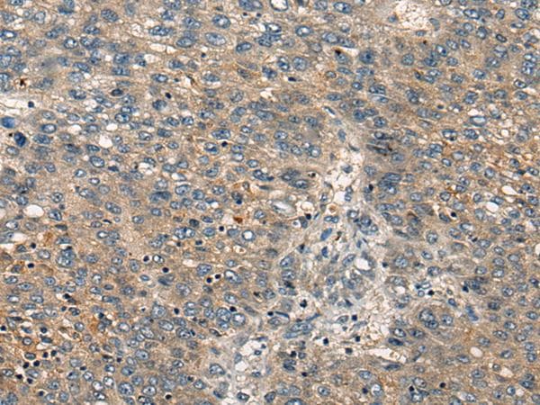 CDKL2 Antibody