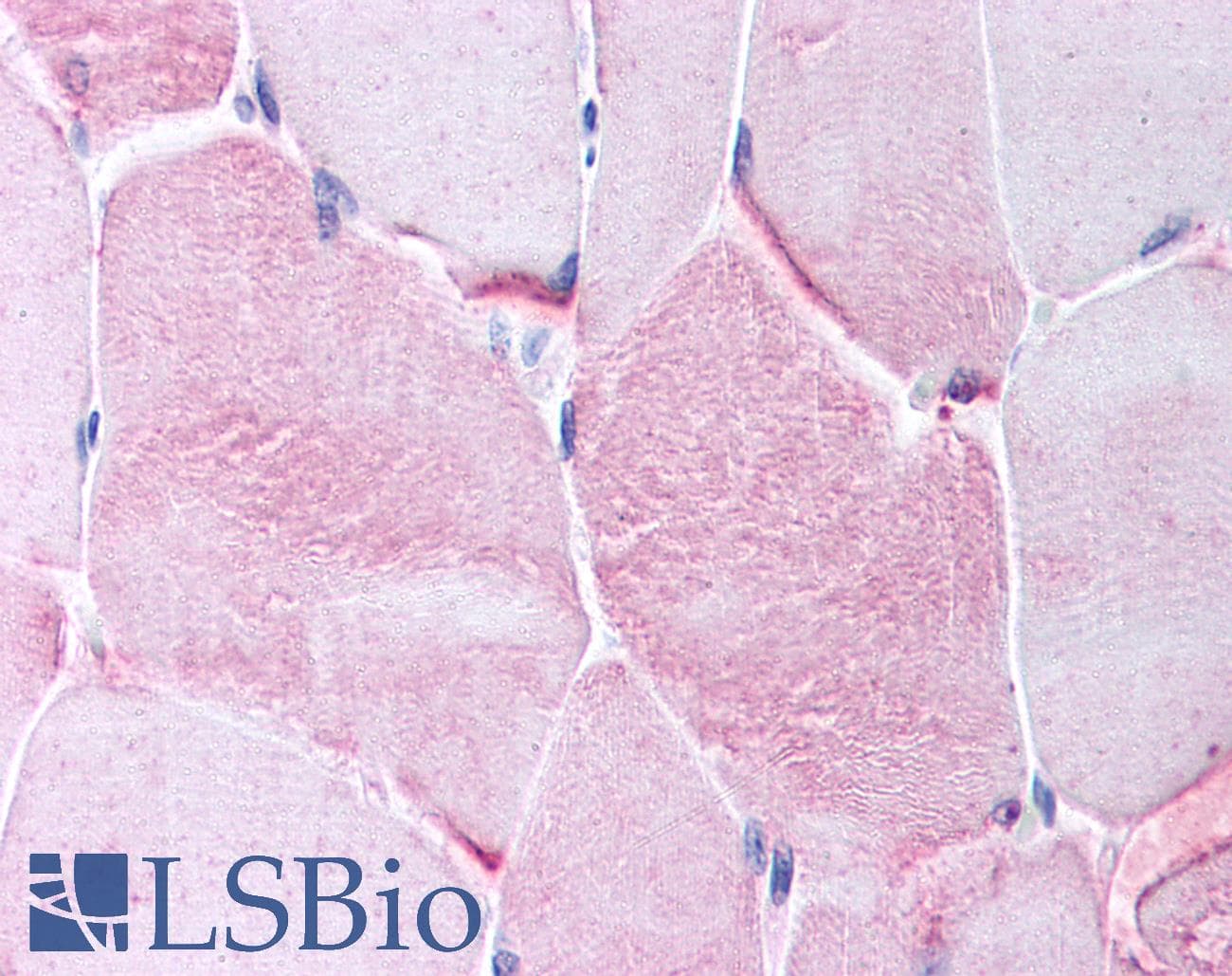 Polyclonal Rabbit anti-Human CACNG1 / CACNG Antibody (aa66-115, IHC, WB)