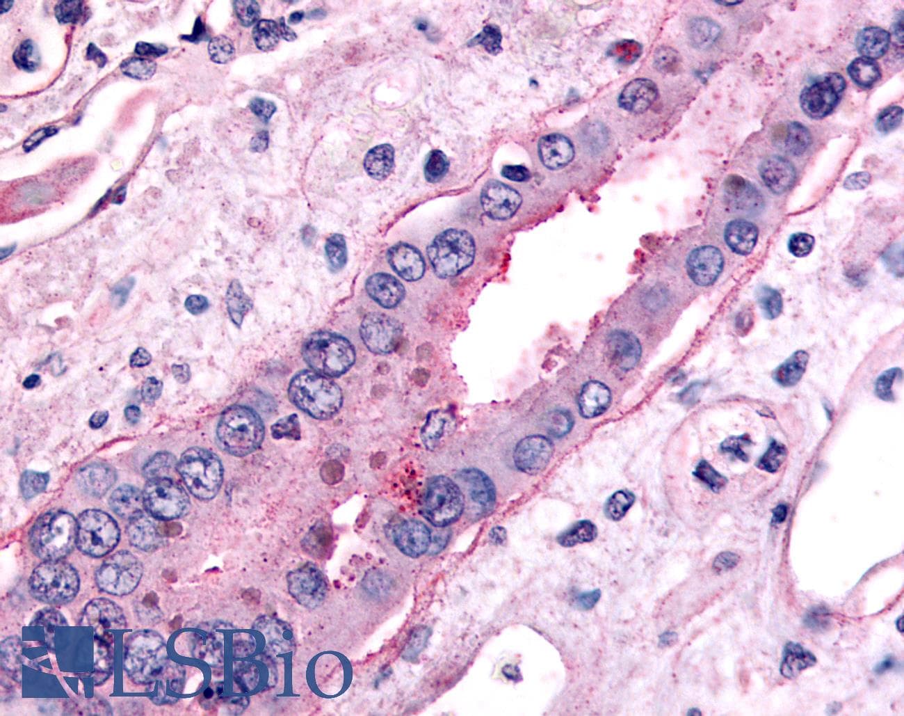 IHC-plus™ Polyclonal Rabbit anti-Human SLC5A2 / SGLT2 Antibody (C-Terminus, IHC)