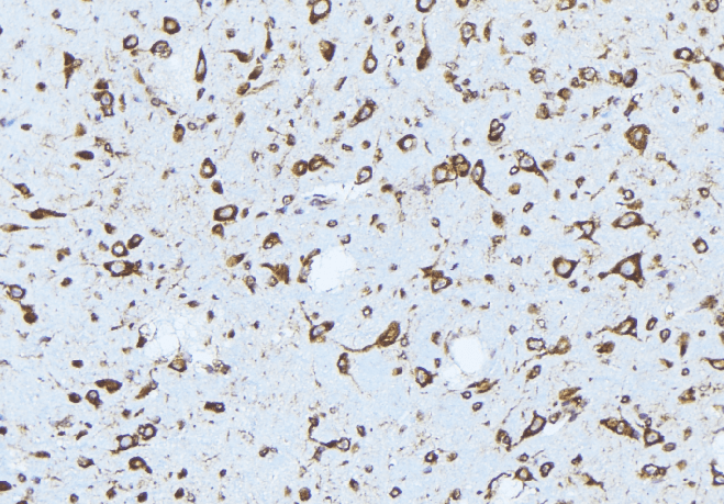 ERBB3 / HER3 Antibody (phospho-Tyr1289)