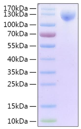 Coronavirus SARS-CoV-2 S1 Protein (Recombinant 6His-AVI, C-terminus)