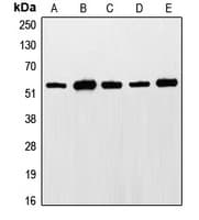 ETS1 / ETS-1 Antibody (phospho-Thr38)