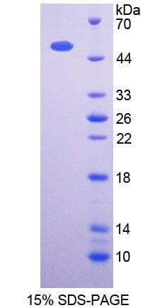 Human OXCT1 Protein (Recombinant His-T7)