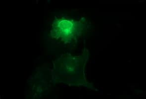 Monoclonal Mouse anti-Human MLANA / Melan-A Antibody (clone OTI2G2, IHC, IF, WB)