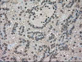 LDHA / LDH1 Antibody (clone OTI2C11)