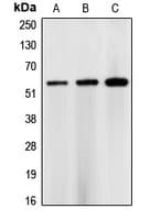 Polyclonal Rabbit anti-Human CHEK1 / CHK1 Antibody (Internal, WB)