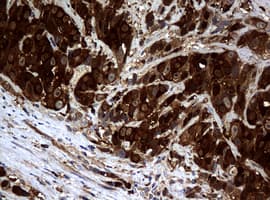 NME1 / NM23 Antibody (clone OTI3F2, Carrier-free)