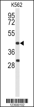 Polyclonal Rabbit anti-Human DFFA / ICAD / DFF45 Antibody (aa304-331, WB)