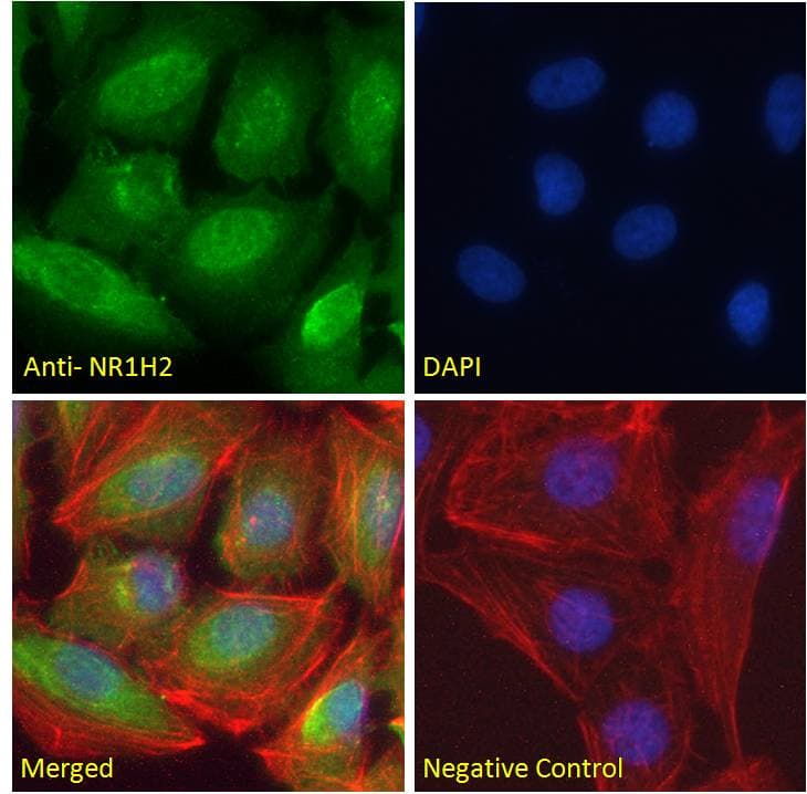 IHC-plus™ NR1H2 / LXR Beta Antibody (aa2-15)