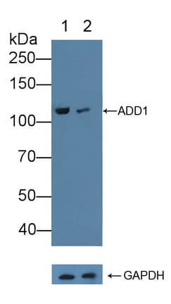 ADD1 / Adducin Alpha Antibody (aa388-560)