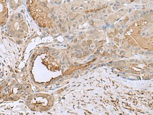 GABARAPL2 / ATG8 Antibody