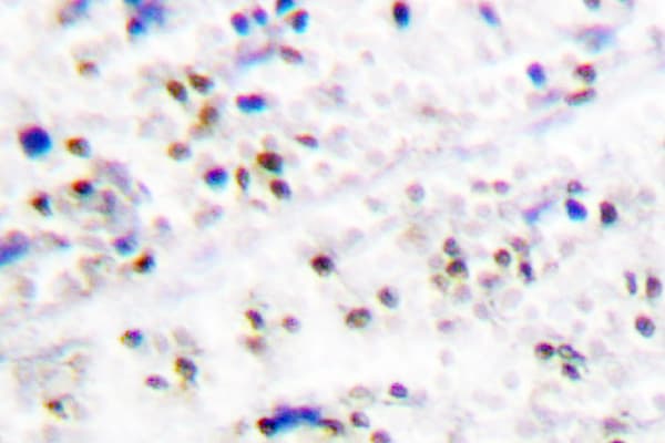 Polyclonal Rabbit anti-Human MCM5 Antibody (Phe51, IHC, IF, WB)