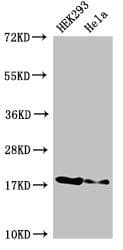 Polyclonal Rabbit anti-Human RNASEH2C / AGS3 Antibody (IHC, IF, WB)
