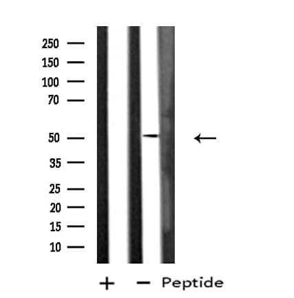 DUSP10 / MKP5 Antibody