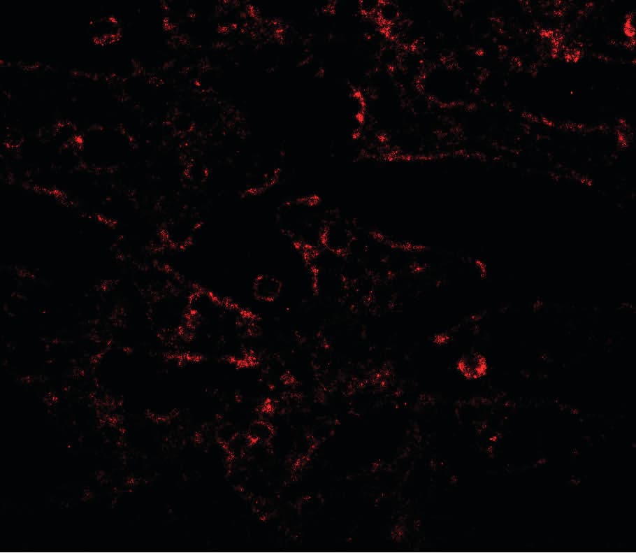 IL17RA Antibody