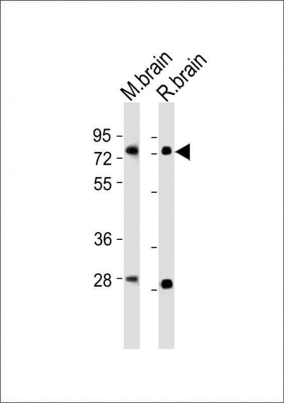 NR4A2 / NURR1 Antibody (aa164-197)