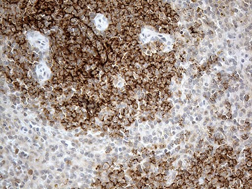 Monoclonal Mouse anti-Human CR1 / CD35 Antibody (clone OTI2A8, Carrier-free, aa1900-2039, IHC, WB)