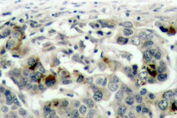 NFKB1 / NF-Kappa-B Antibody (Ala901)