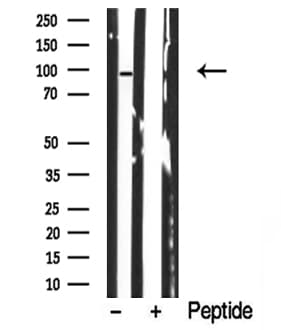MAP3K11 / MLK3 Antibody