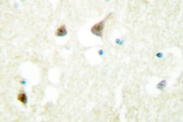 Polyclonal Rabbit anti-Human HNRNPC / HNRNP C Antibody (Asp271, IHC, IF, WB)