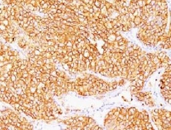 CA9 / Carbonic Anhydrase IX Antibody (clone SPM314, Azide-free, BSA-free)