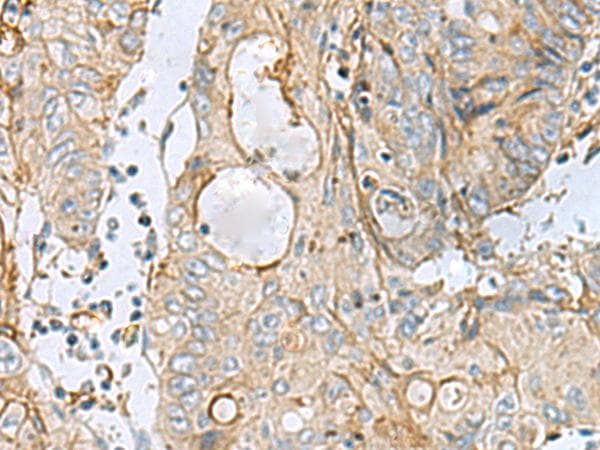 Polyclonal Rabbit anti-Human MTHFD2 Antibody (IHC)