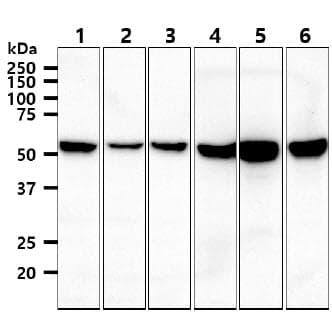 PathPlus™ Vimentin Antibody (clone AT5H8)
