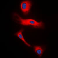 PathPlus™ GCG / Glucagon Antibody (Internal)