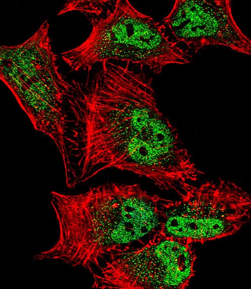 MEF2C Antibody (Ser387)