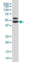 Monoclonal Mouse anti-Human GDI1 Antibody (clone 1H3, WB)