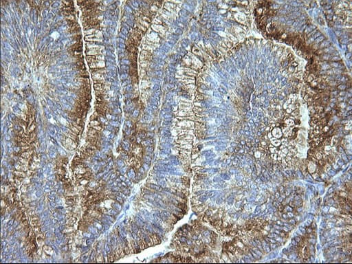 Monoclonal Mouse anti-Human SCAMP2 Antibody (clone OTI1H10, IHC, WB)