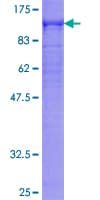 Human DMD / Dystrophin Protein (Recombinant GST)