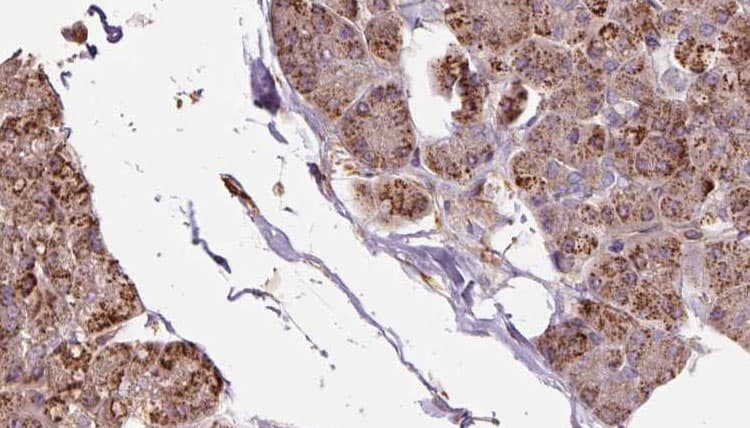 OXA1L / OXA1 Antibody