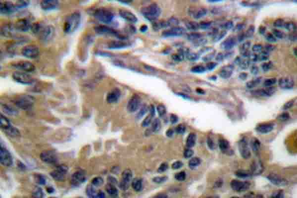 Polyclonal Rabbit anti-Human NFE2L2 / NRF2 Antibody (Leu593, IHC, WB)
