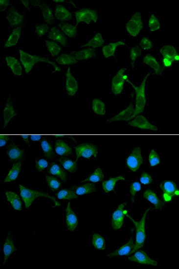 TOLLIP Antibody