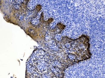 Polyclonal Rabbit anti-Human KRT5 / CK5 / Cytokeratin 5 Antibody (IHC, WB)