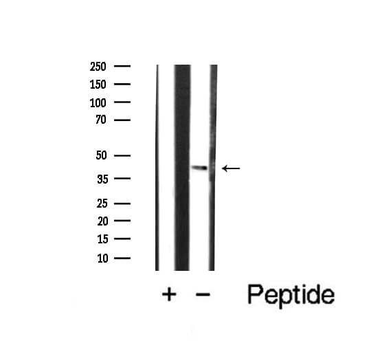 CCR5 Antibody