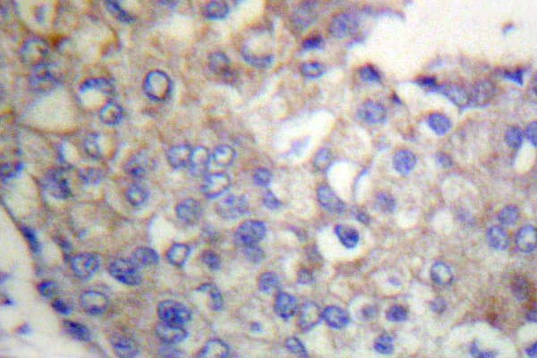 Polyclonal Rabbit anti-Human FGFR1 / FGF Receptor 1 Antibody (Leu760, IHC, WB)