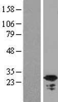 C19orf39 Protein (Over-Expression Lysate Myc-DDK (Flag))