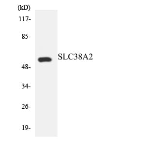 Polyclonal Rabbit anti-Human SLC38A2 / SNAT2 Antibody (aa141-190, WB)