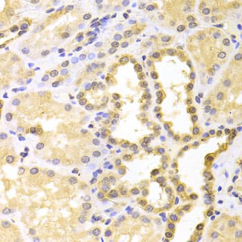 IHC-plus™ Calgizzarin / S100A11 Antibody
