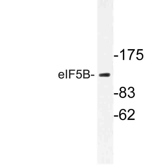 EIF5B / IF2 Antibody (His1086)